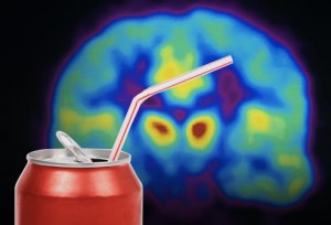 「糖質中毒」糖が脳をバカにする！　糖に変わる脳の栄養源「ケトン体」